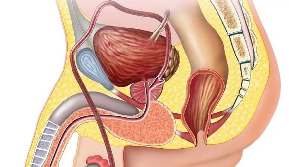 Chronische Prostatitis
